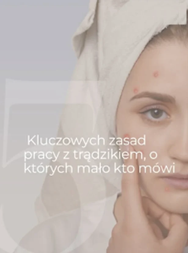 Kluczowe zasady pracy z trądzikiem, o których mało kto mówi